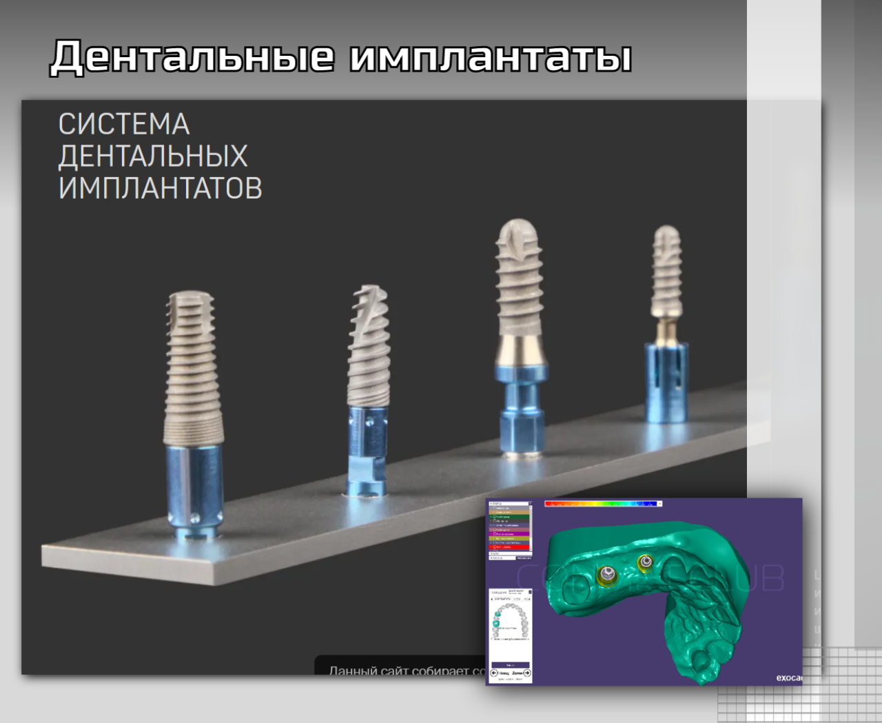 Дентальные имплантаты